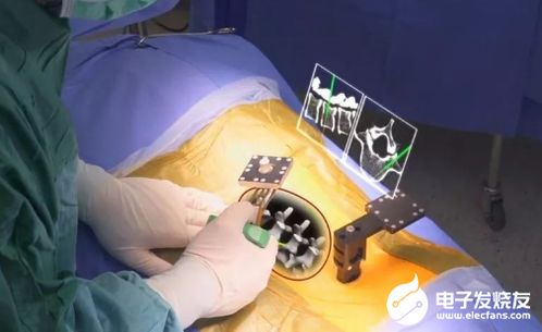 如何借助ar技术实现在医疗领域的充分利用