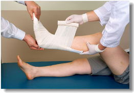 医用高分子夹板 ,济宁康利达医疗科技有限责任公司