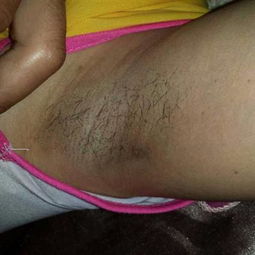 生活保健 其他疾病健康经验分享 第22846页 39问医生 39健康网