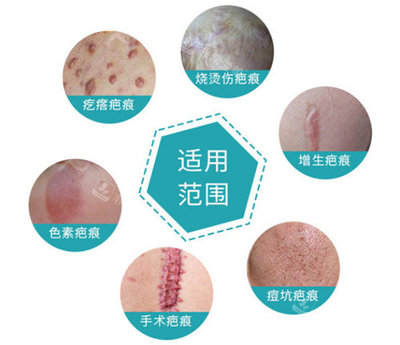 北京京城皮肤医院可靠吗?北京京城医院是._整容问答