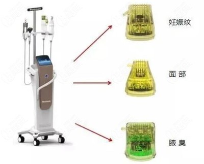 黄金微针4.0治疗腋臭 次数与维持时间解析